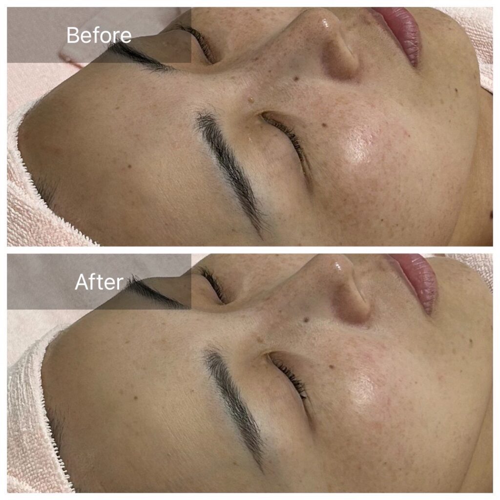 丸亀市 トータルビューティーサロンみんと