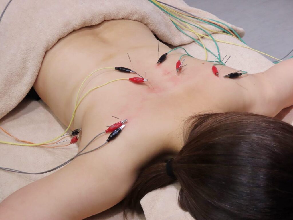 宇多津町 はりきゅう笑美福(えみふく)